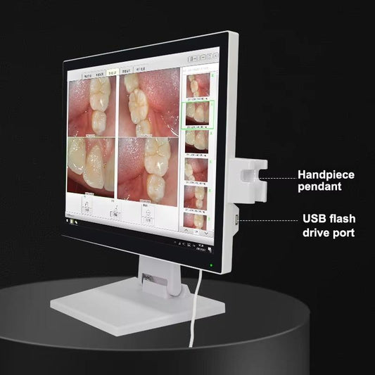 17-Inch Electric Dental Endoscope All-in-One PC Monitor Wireless WiFi Intraoral Camera Bracket Oral Examination Tool Dental