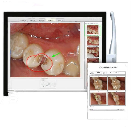 High Quality 17 Inch Endoscope Camera Dental Endoscope hd Video Wireless Wifi Oral Dental Endoscope