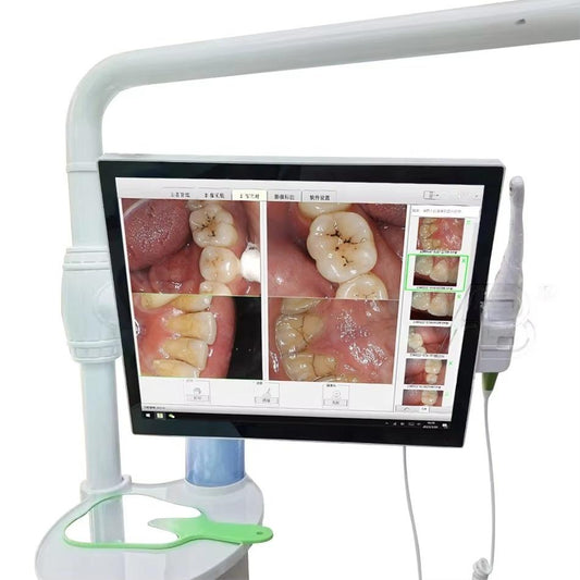 17 Inch Touch Screen Dental All in One Intraoral Camera With Monitor Wireless Wifi Endoscope HD Dental Equipment