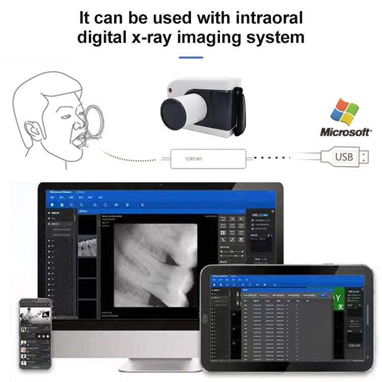 Dental Area-Specific High Frequency Portable Xray Unit Digital Xray Sensor Xray