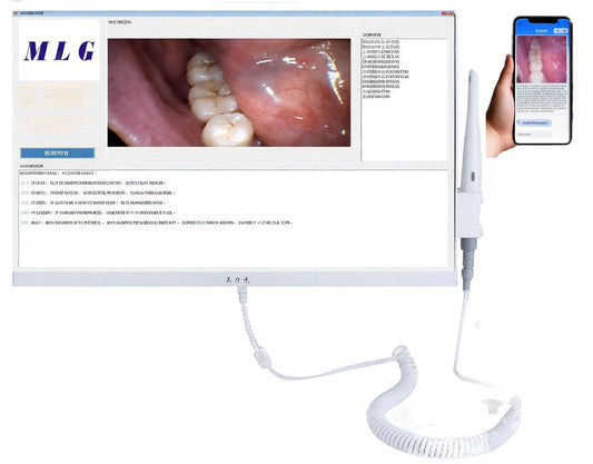 17 Inches Dental Camera Medical LED Dental Endoscope Dental Endoscope Camera Intraoral Camera Scanner