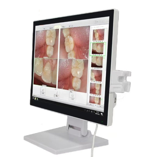 High Quality 17 Inch Endoscope Camera Dental Endoscope hd Video Wireless Wifi Oral Dental Endoscope