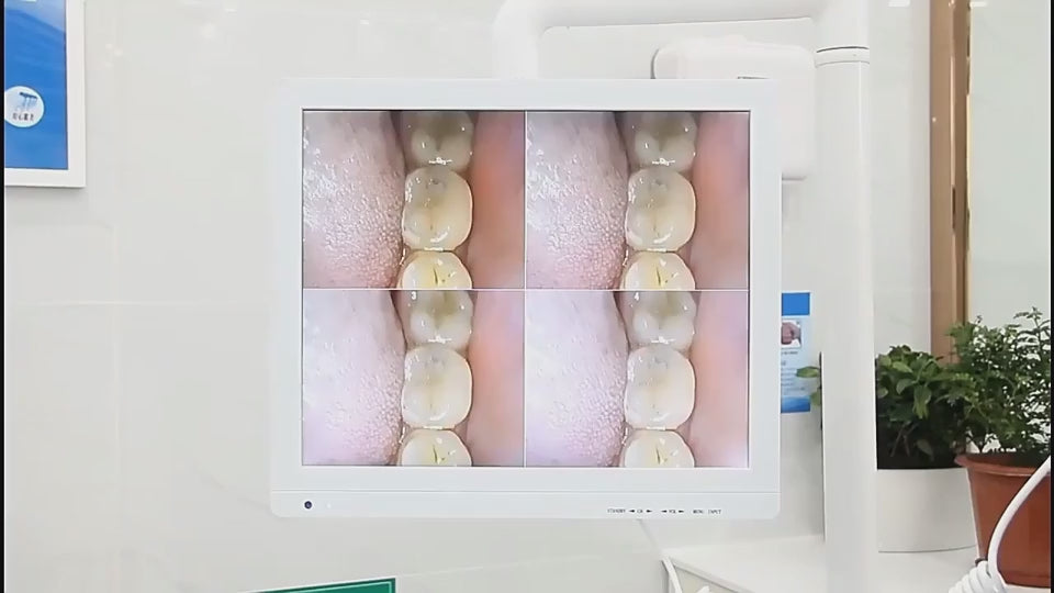 17 Inch Touch Screen Dental All in One Intraoral Camera With Monitor Wireless Wifi Endoscope HD Dental Equipment